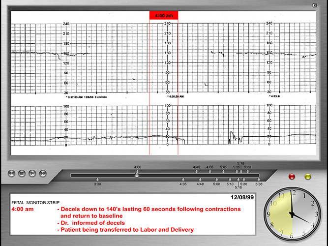 Timelines-Charts-Graphs - The Presentation Group - Trial Exhibits