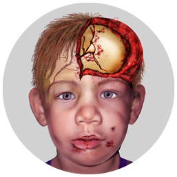 Custom Medical Illustration